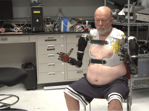 cummins - prosthetic arms