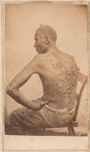 McPherson & Oliver, “The Scourged Back” (1863)